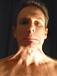 Cardassian neck